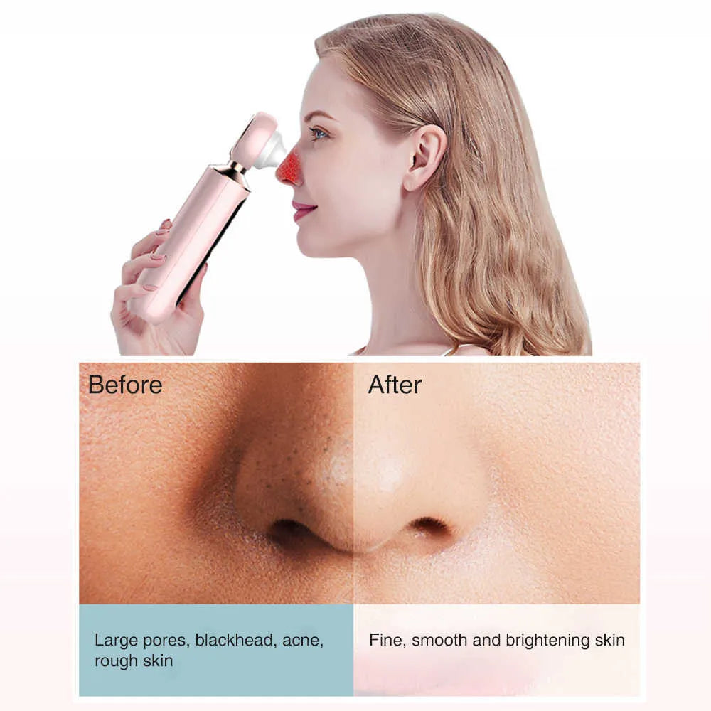 Buy Wafir™ Blackhead Suction Machine