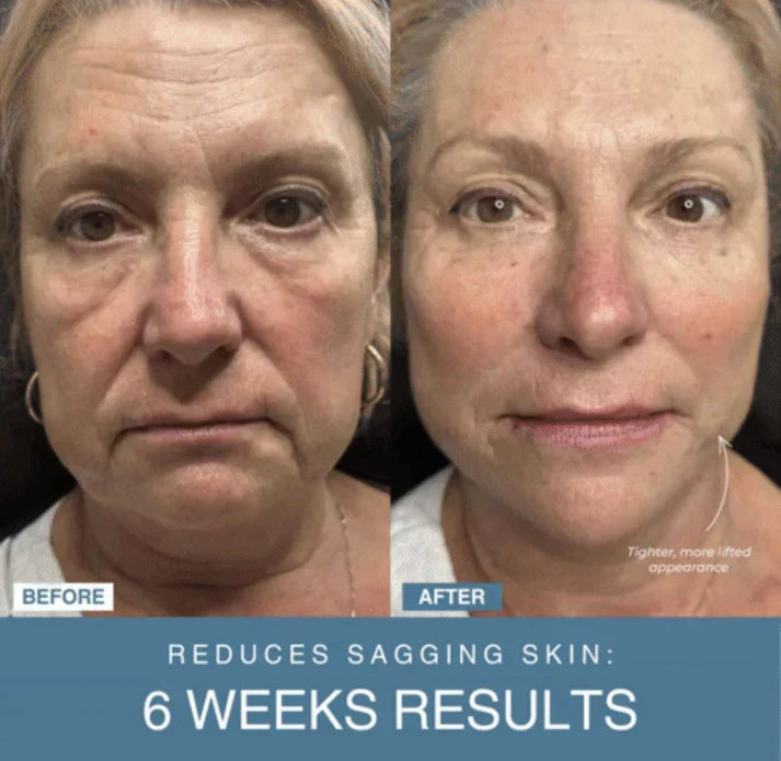 Buy Wafir™ 7-in-1 LED Anti-Aging/Wrinkle Apparatus
