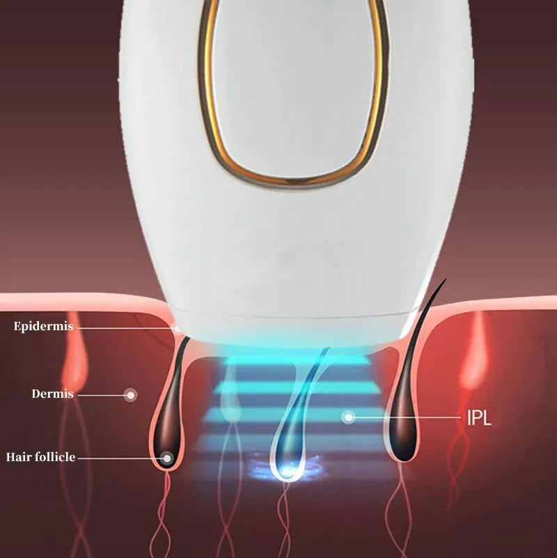 Buy Wafir™ IPL Laser Hair Removal – جهاز إزالة الشعر بالليزر IPL